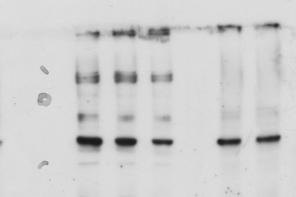 Western blot (public domain)