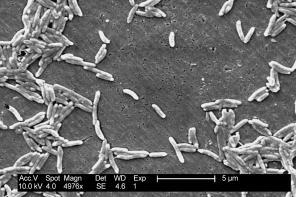 Campylobacter fetu (public domain)